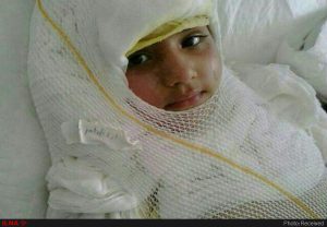 درخواست کمک فوری آتنای 9 ساله که  دچار سوختگی شده است/شکایت طلبکاران عمل آتنا برای مادر رنج کشیده اش و درخواست های شرم آور/کمک های مردمی و خیرین به شماره حساب داخل خبر