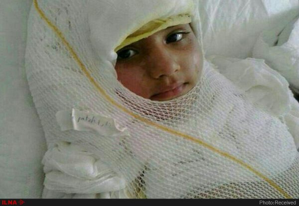 درخواست کمک فوری آتنای 9 ساله که  دچار سوختگی شده است/شکایت طلبکاران عمل آتنا برای مادر رنج کشیده اش و درخواست های شرم آور/کمک های مردمی و خیرین به شماره حساب داخل خبر