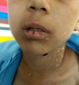 جزئیات جدید از آزار وحشتناک کودک ۹ ساله در سبزوار/نامادری سنگدل دستگیر و کودک بستری شد