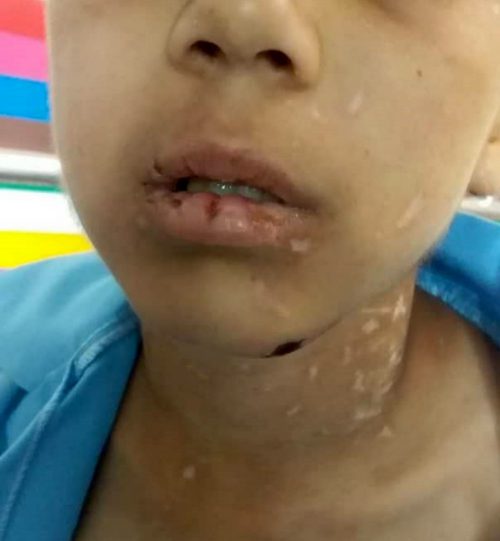 جزئیات جدید از آزار وحشتناک کودک ۹ ساله در سبزوار/نامادری سنگدل دستگیر و کودک بستری شد