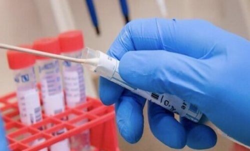 فهرست به روزرسانی شده آزمایشگاه‌های تشخیصی کرونا در گیلان اعلام شد