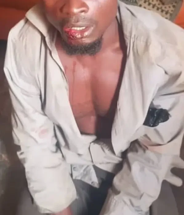 آدم‌خواری در اوگاندا؛ مردی متهم به قتل و خوردن اجساد ۳۸ نفر بازداشت شد